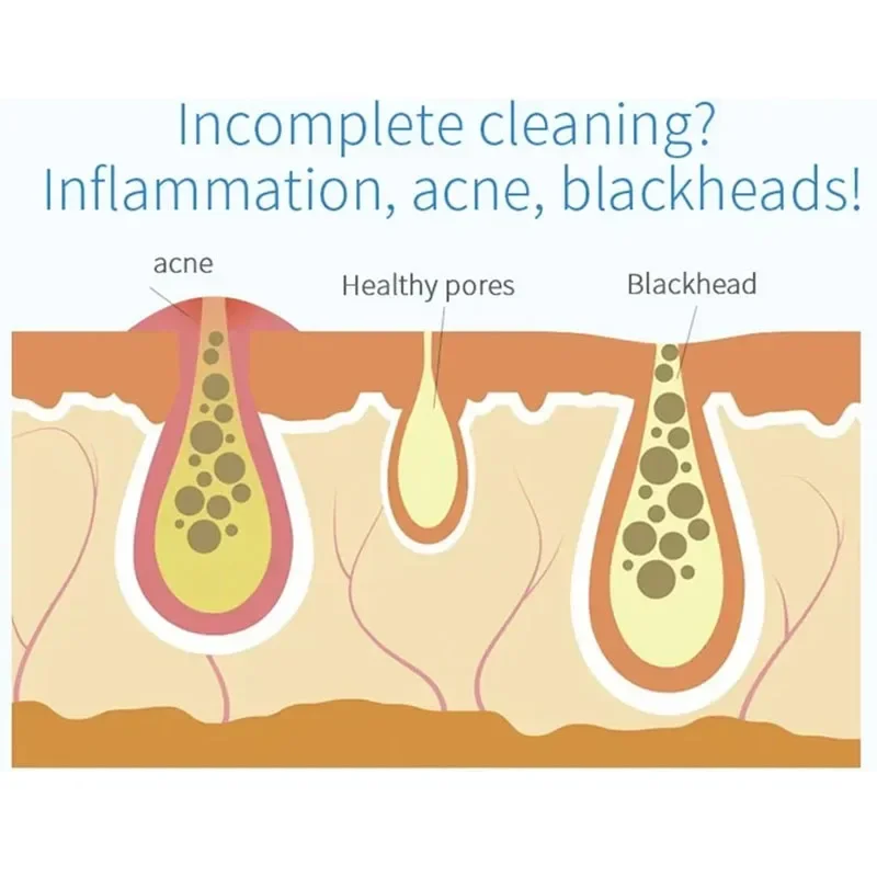 Novo dispositivo de beleza peeling pequena bolha instrumento injeção oxigênio hydra dermoabrasão aqua limpeza facial sucção cravo