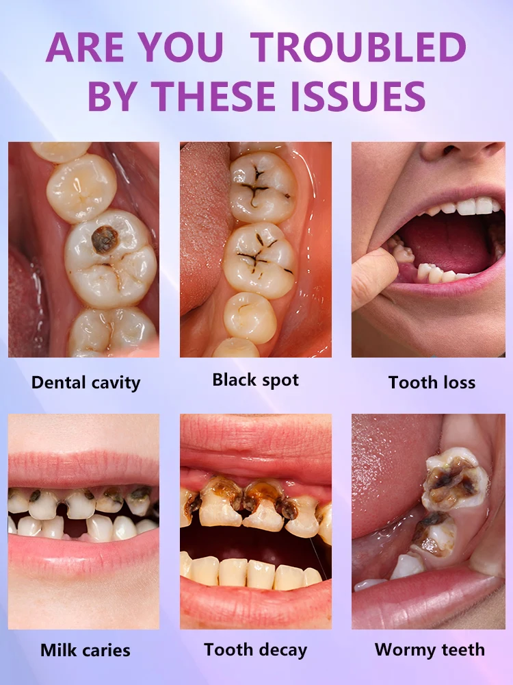 Tratamientos anticaries para caries y caries.