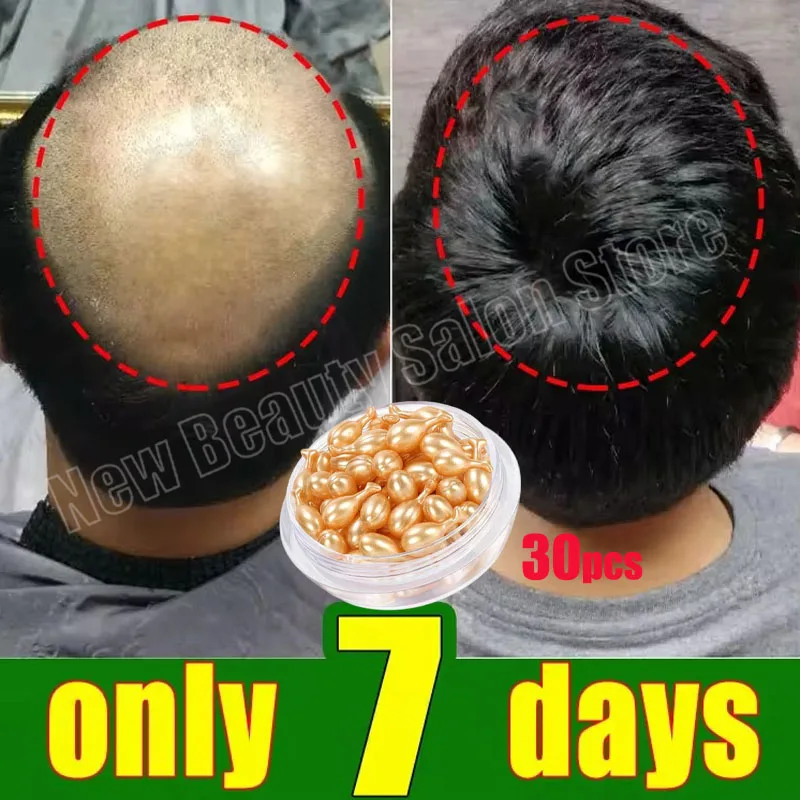 Suero para el crecimiento del cabello, cápsula esencial de crecimiento rápido de 7 días, antipérdida de cabello, reparación de calvicie, tratamiento del cuero cabelludo dañado para mujeres y hombres