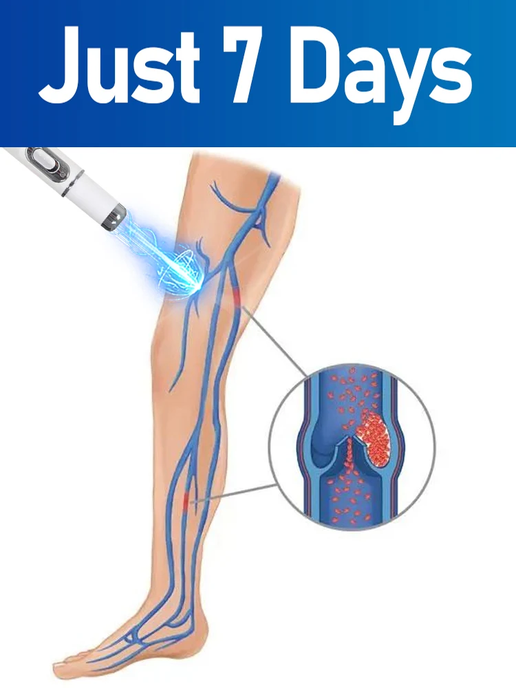 

Ручка с синим светом для ухода за телом: защищает ваши ноги и обеспечивает уход за кожей.