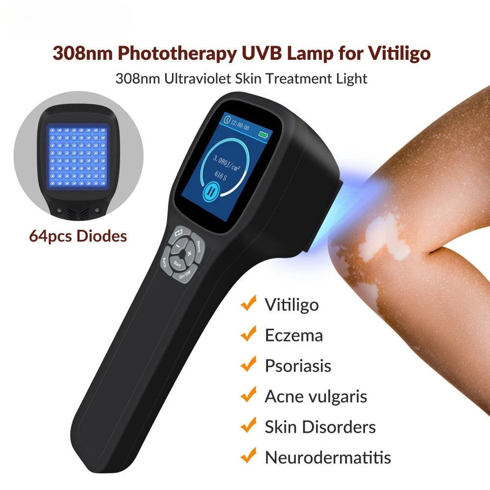 Frovab 308nm UVB terapia de luz excimer 64 diodos lámpara de fototerapia portátil para Vitiligo psoriasis eczema cuidado de enfermedades de la piel en el hogar
