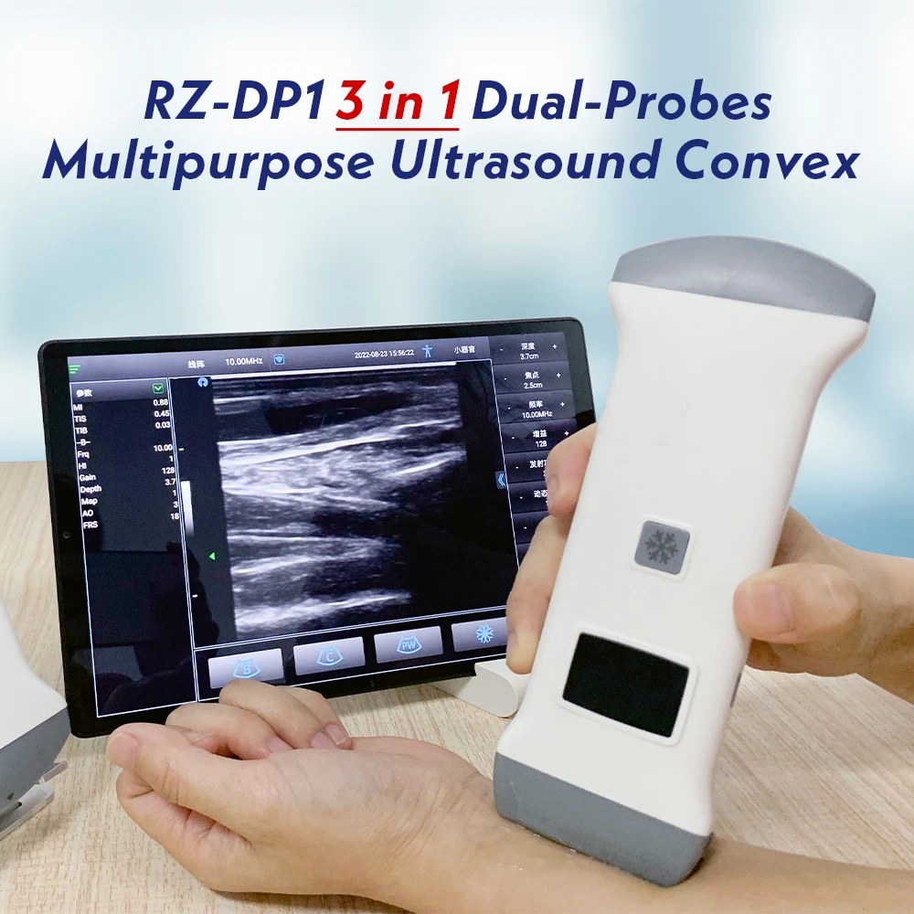 128E Wireless Dual-Probes Ultrasound Convex +Linear+ Cardiac Probe