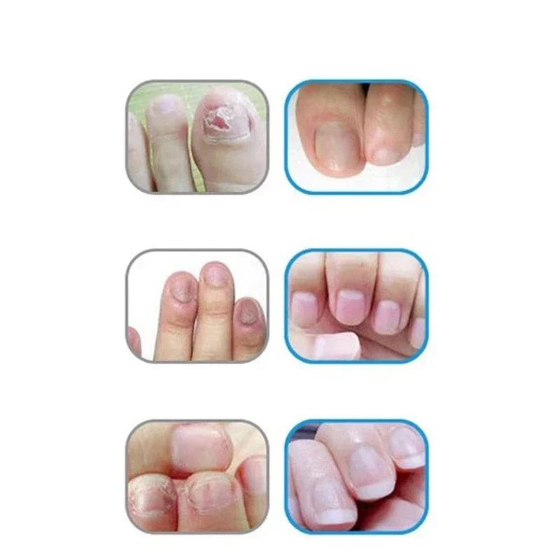 Nail Cuticle Oil Pen 2pcs Nourishment Oil Pen Nail Treatment Revitalizer Nourish Manicure Nail Care Product Set