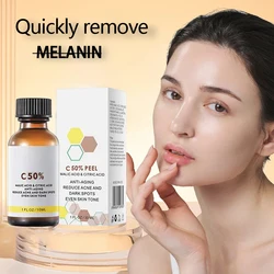 High Quality 50% Chemical Peel Peel Acid Skin Superforce Peel Pigmentation Lightening Melanin Acne Treatment Remove Scar