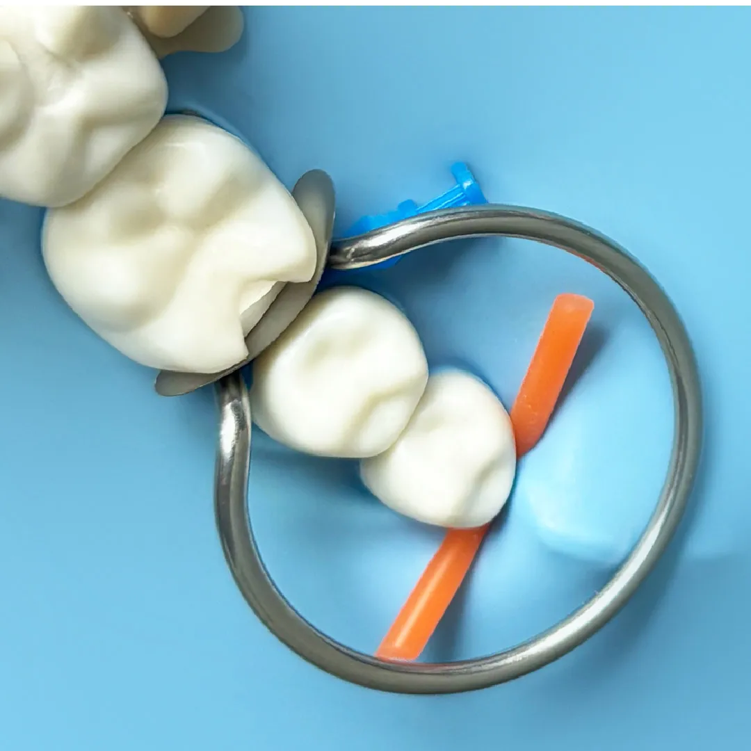 100pcs Dental Sectional Matrix System 1.398 Matrices Kits with 2 Metal Clamp Rings or Bands Refills 0.035mm Thickness for Dentis view 6