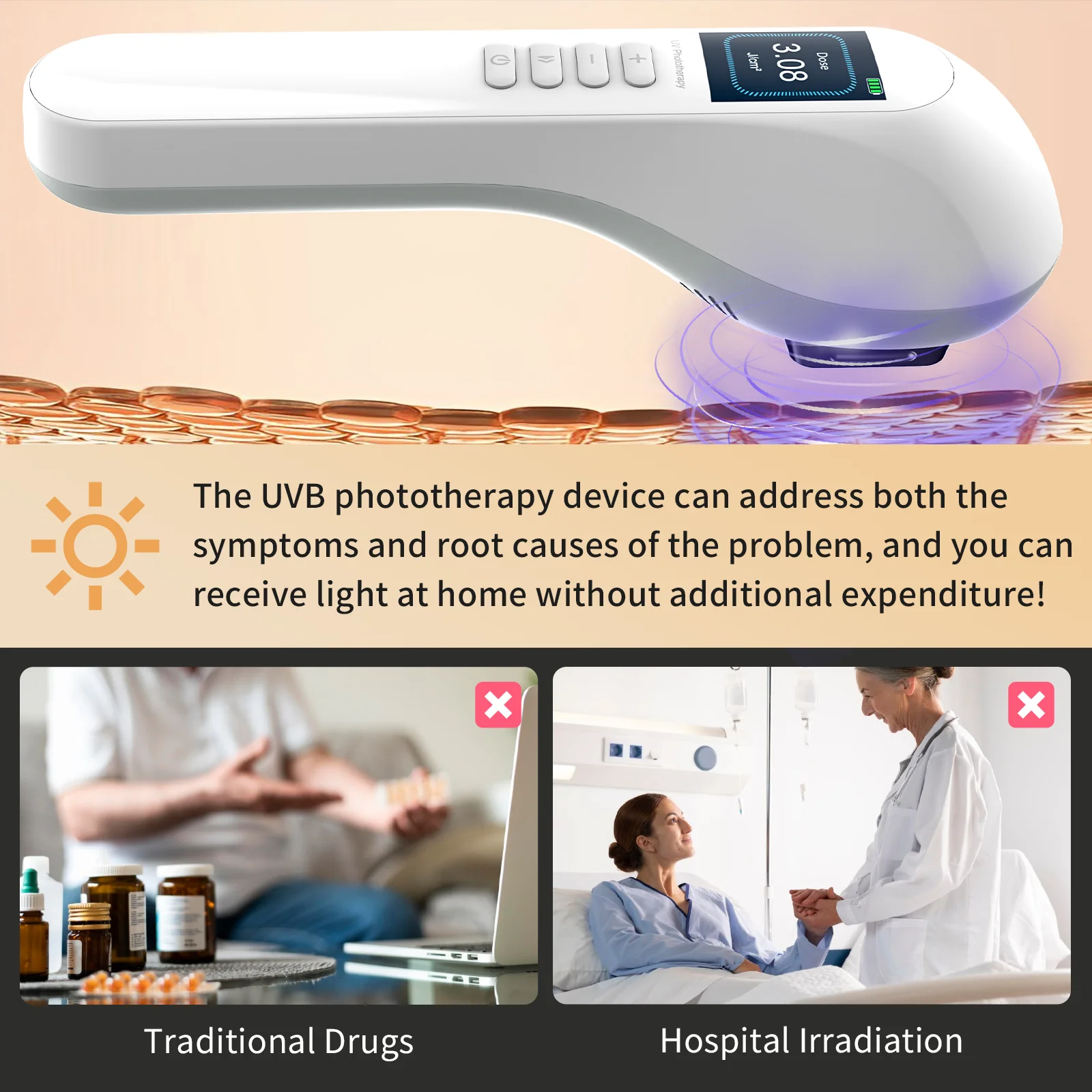 KTS UVB Phototherapy Lamp Device for Vitiligo Treatment 308NM UV Narrow Band Ultraviolet Light Therapy Psoriasis Spots Eczema