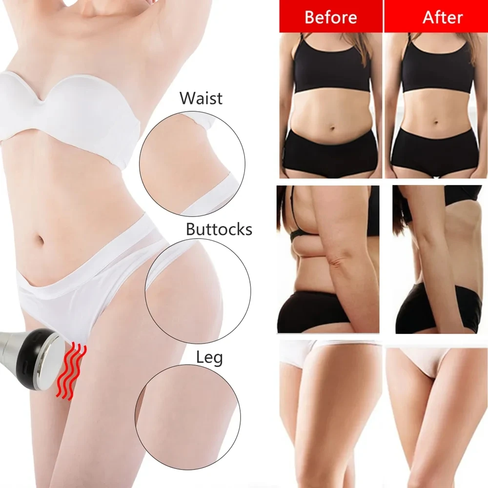 New Arrival 9 In 1 40K Kim 8 z EMS Patch ultradźwiękowa kawitacja próżniowa RF redukcja cellulitu Laser Lipo odchudzanie SPA Machin