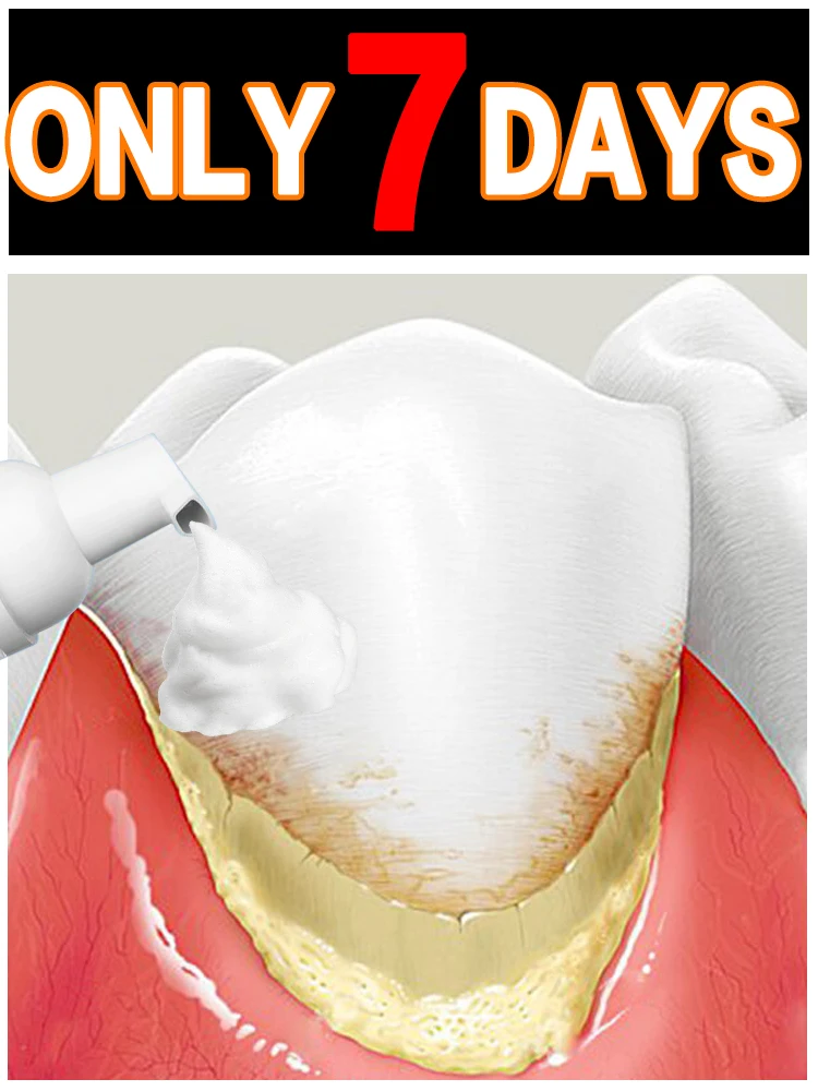 Remove manchas e dissolve tártaro com resultados escaláveis