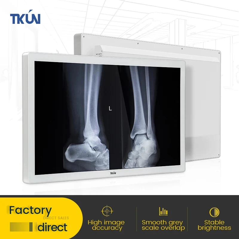 Factory Sales Radiology Monitor 27inch P270WQUGA-SDI 1000nits  High Resolution Anti-glare 8MP Medical Monitor