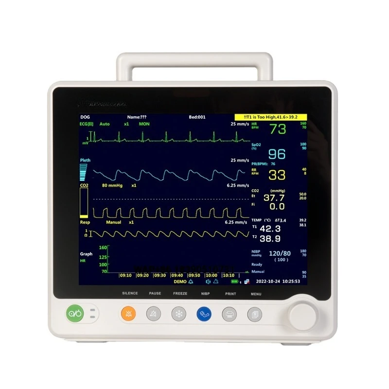 Mnvet-20 series multi-parameter animal with 12.1 inch high definition LCD touch screen veterinary medical equipm