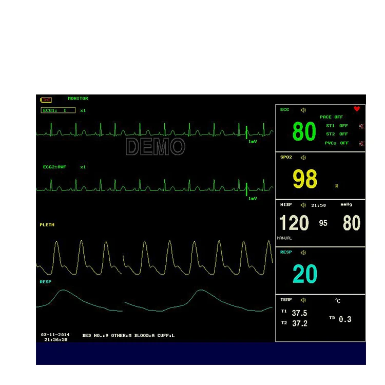CMS8000 Multi-Parameter Patient Monitor CE Certified 12.1