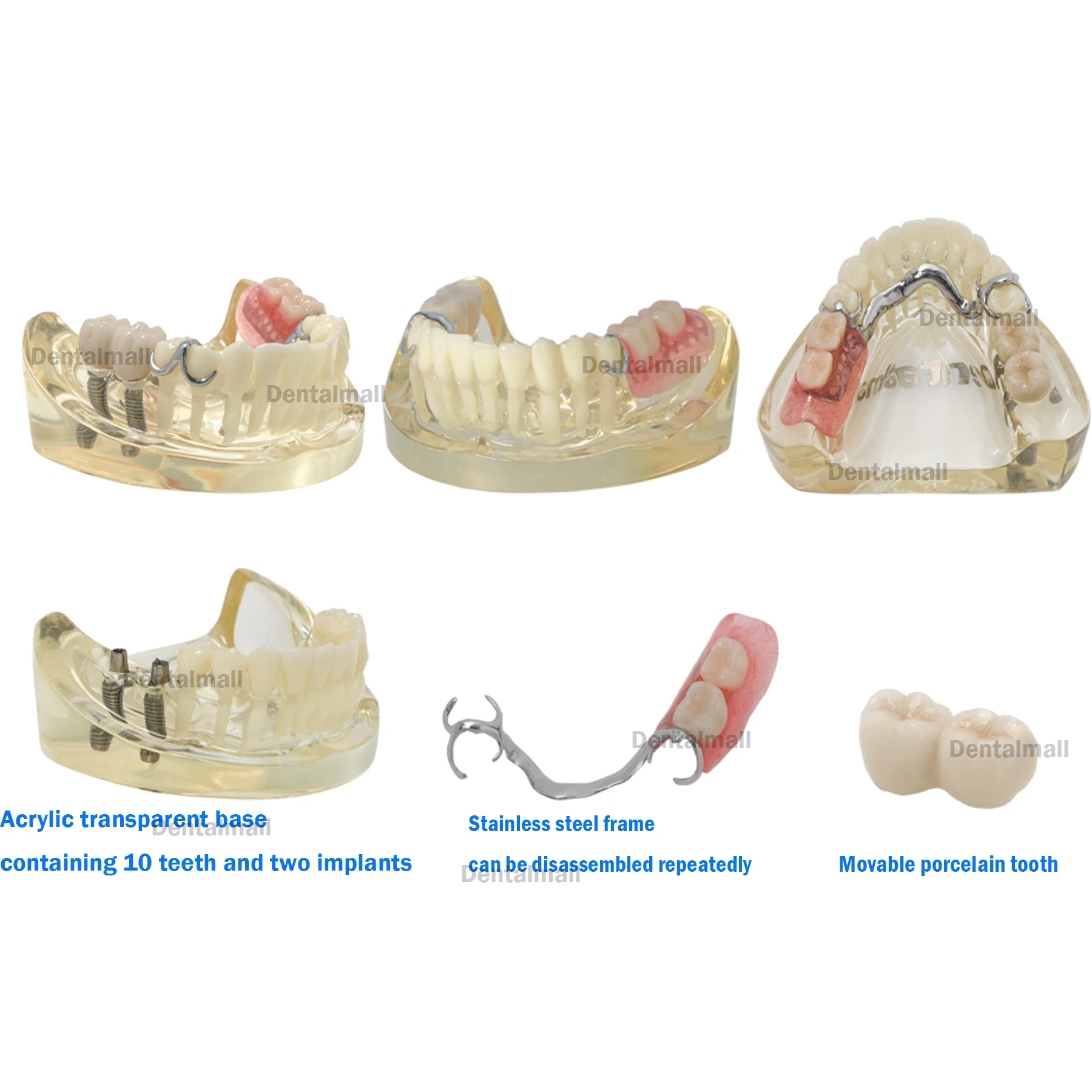 Dental Typodont Implant and Restpration Teeth Model with Partial Denture M6022