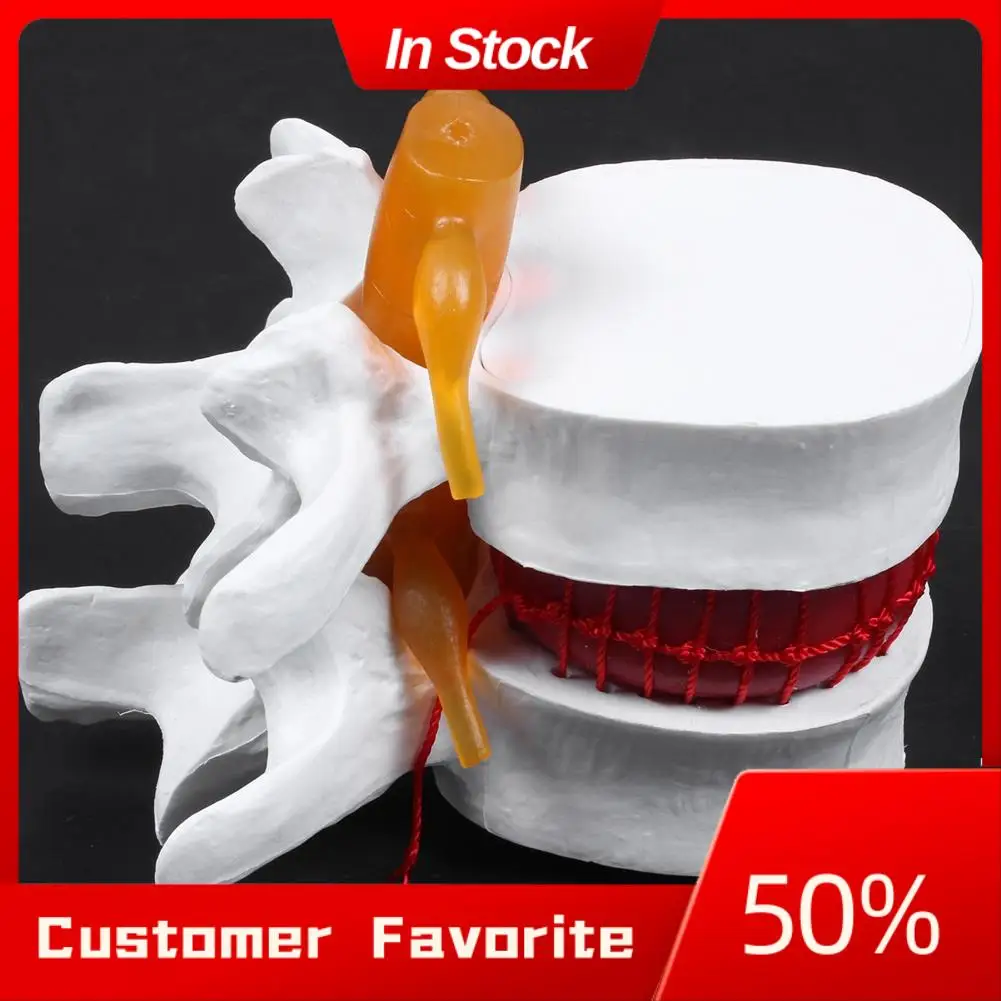 

AT03 Top 1 Pcs Skeleton Spine Lumbar Disc Herniation Teaching Model & 1 Pcs Human Anatomy Skeleton Spine Vertebral Model