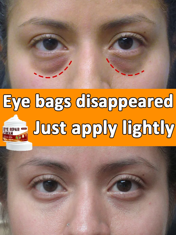 Just one touch can eliminate eye bags and restore youthfulness!