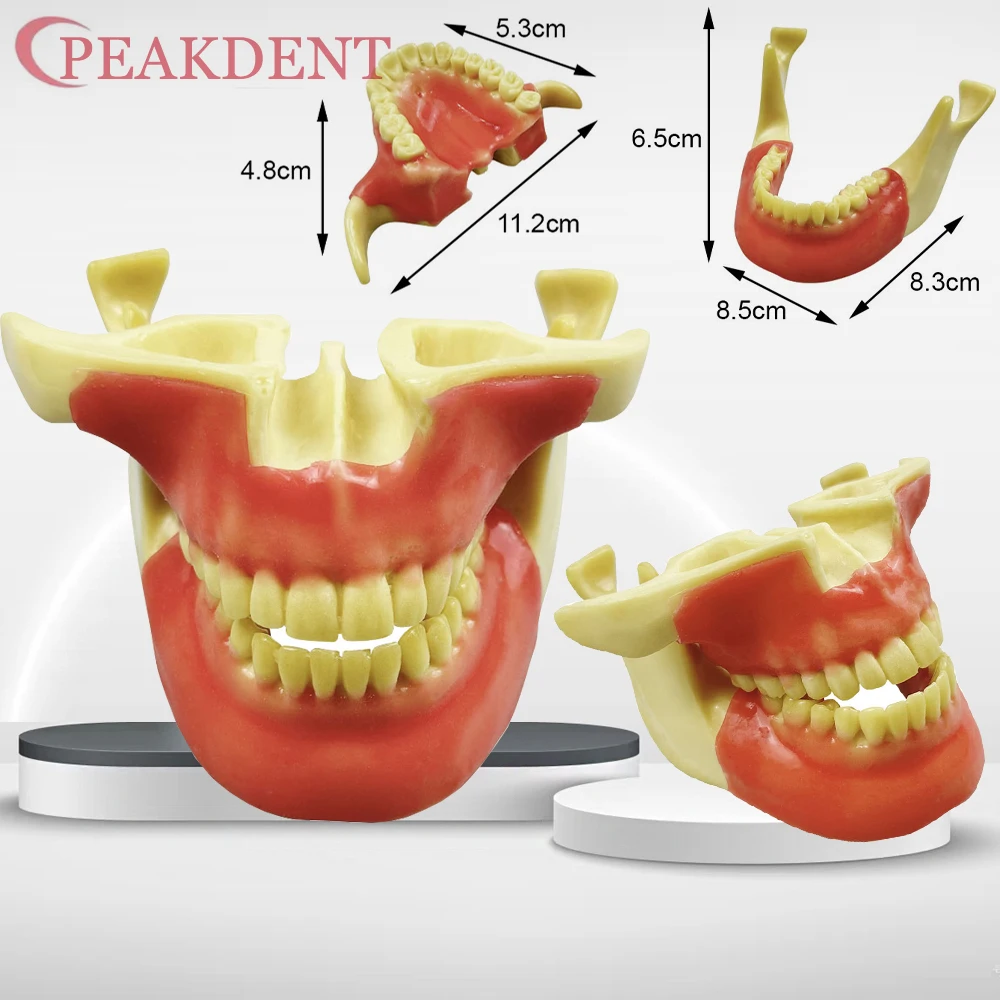 

Dental Implant Anchorage Screw Practice Model With Removable Dental Teeth Model Implants Screw Self Taping Anchor Screws Model