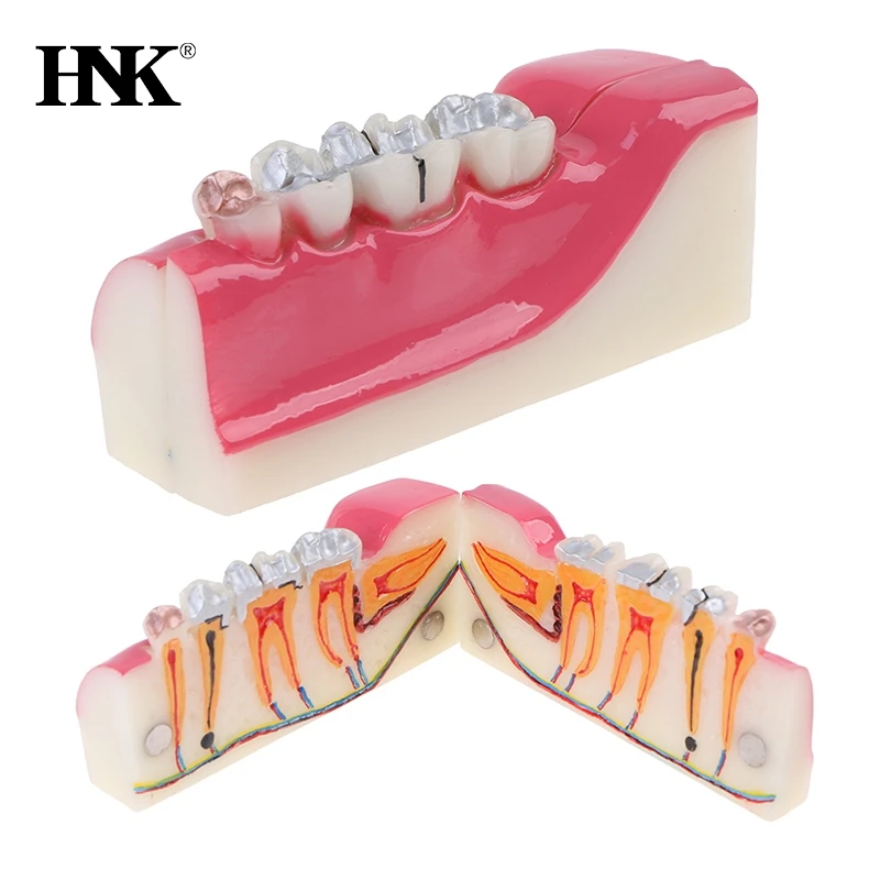 

Teeth Anatomy Study Model Molar Cross Section Decomposition Model Of Lower Right Posterior Teeth Model