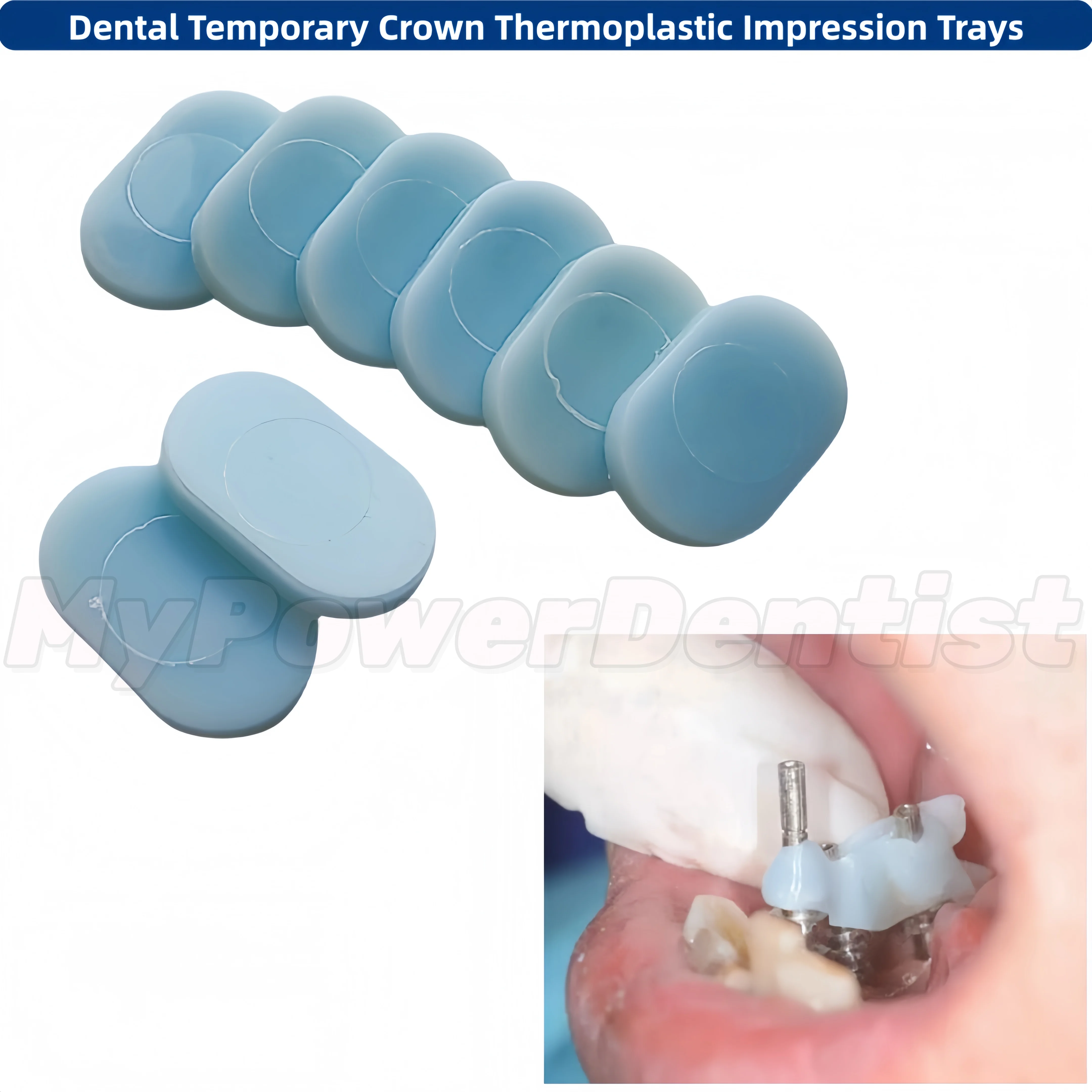 Dental Temporary Crown Thermoplastic Impression Trays Molding Polymer Sheet TEMP TABS