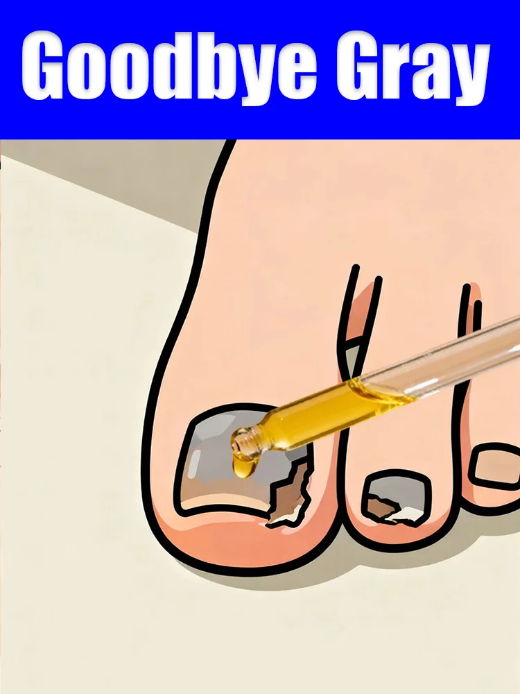 

Dropper tool for treating onychomycosis and nail discoloration