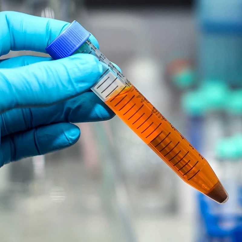 100Pcs Conical Centrifuge Tubes 15Ml With Screw Caps, Graduated And Write Marks Lab Test Container