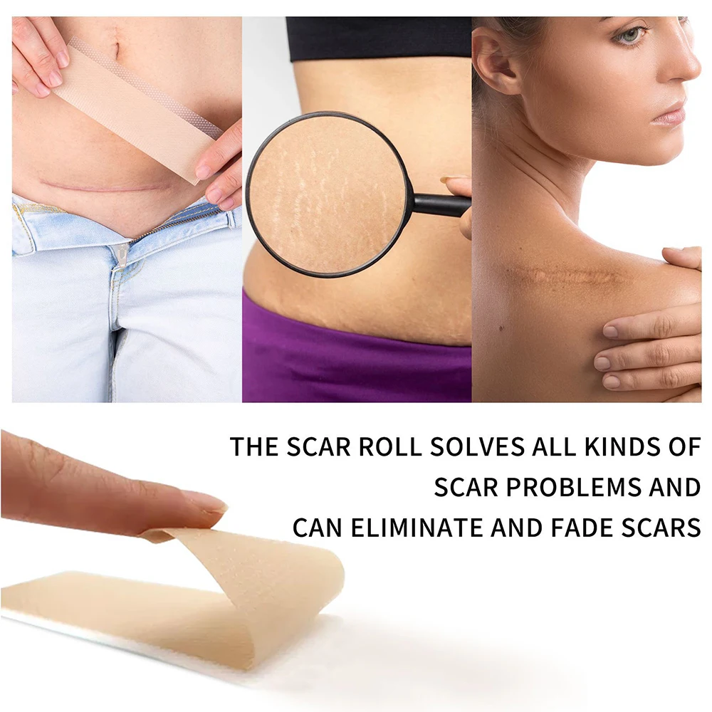 Silicone Scar Tape Roll Strips Reusable Scar Removal Sheets Scar Strips for Keloid C Section Surgery Burn Keloid Acne et