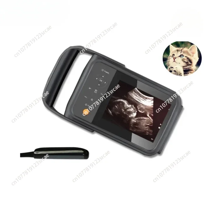 Medical Handheld Ultrasound Scanner Portable Ultrasound Diagnostic System