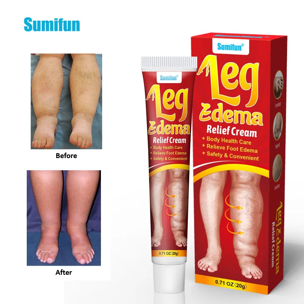 

Anti- Edema Cream Leg Edema Muscle Swelling Care Massage Cream K10162