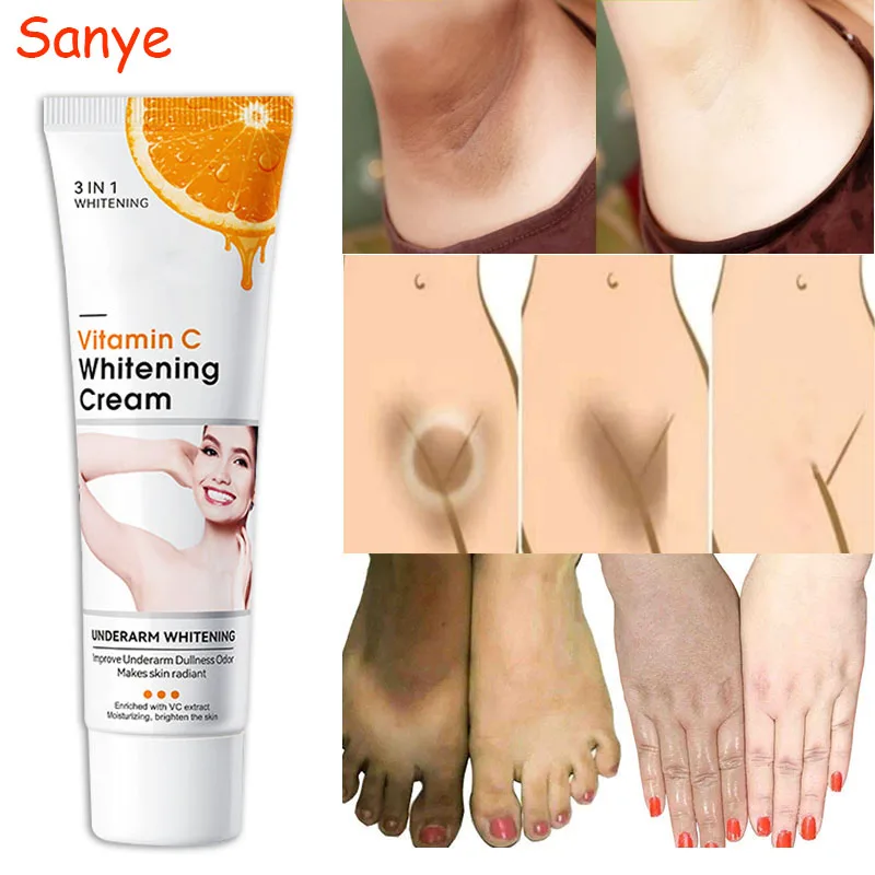 Crème éclaircissante à la vitamine C pour le corps, crème éclaircissante pour les ati elles, les coudes et les genoux, crème hydratante pour la peau, crème éclaircissante pour la mélanine