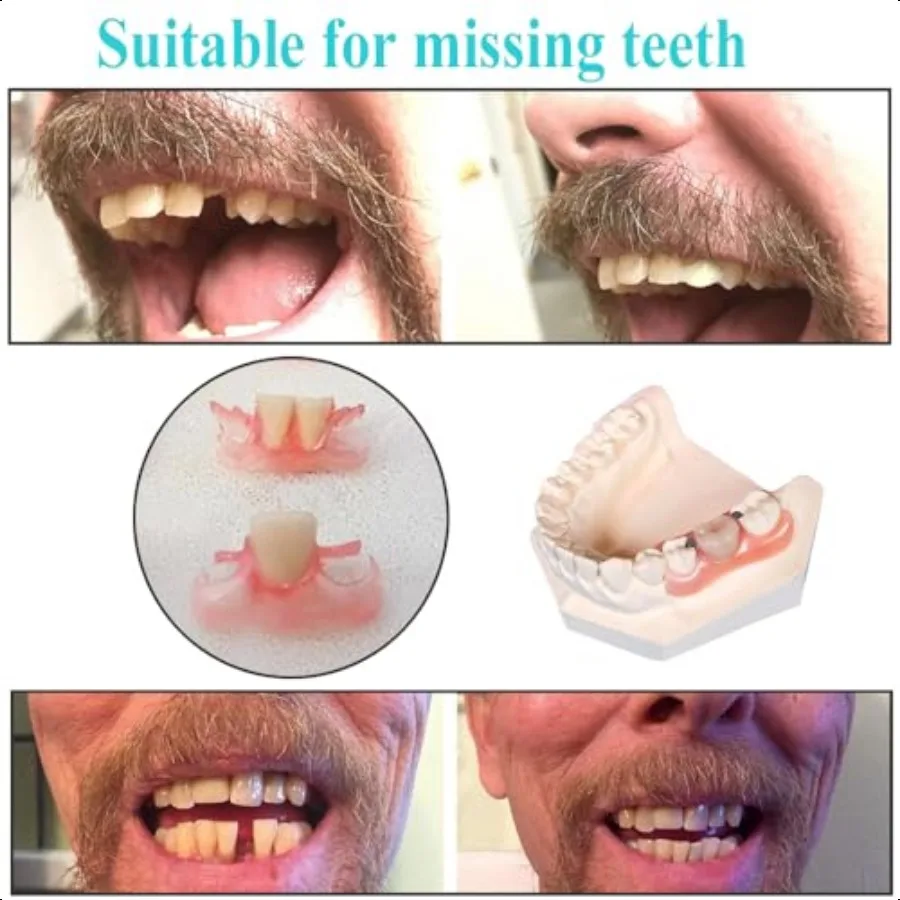 Dentaduras falsas kit diy fácil e conveniente diy reparação de dentes falsos dentes falantes ou diy kit de dentadura completa dentes falsos topo e