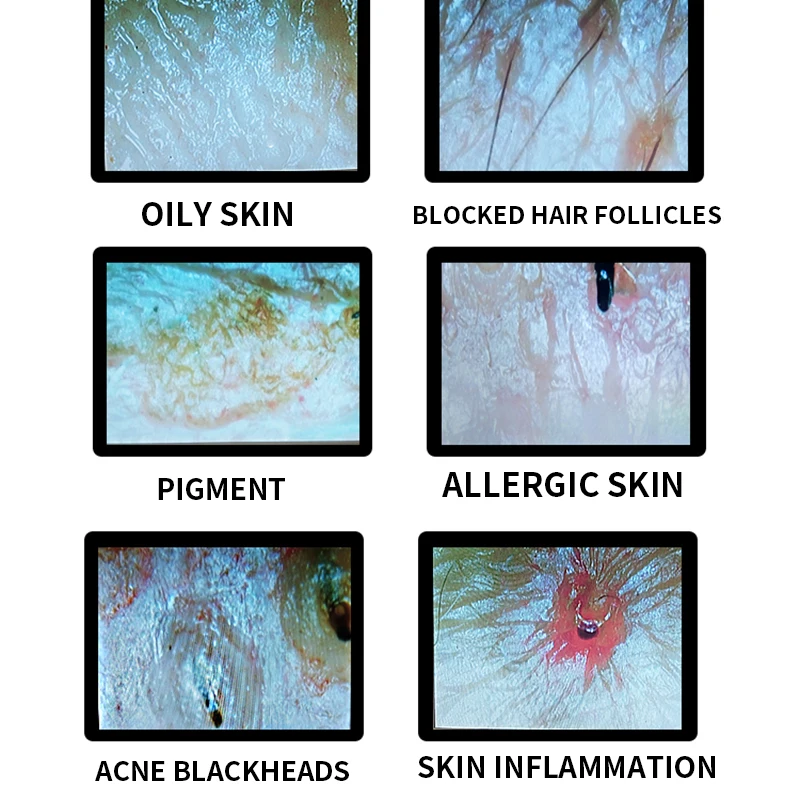 كاشف بصيلات الشعر برأس 7 بوصة مكبر 200 مرة أداة اختبار تحليل الوجه بالبشرة عالية الوضوح