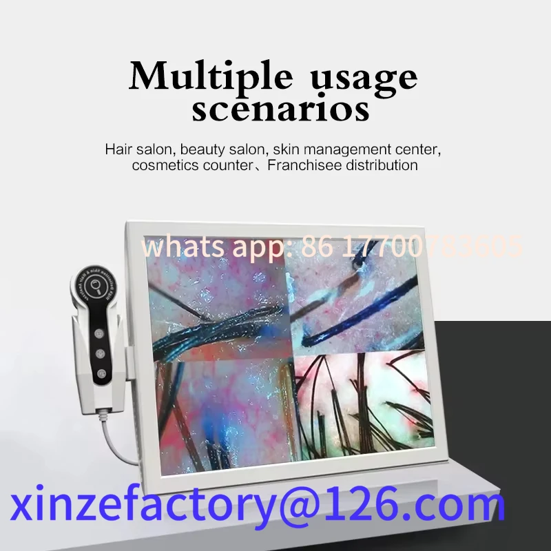 

Customizable Professional Hair Follicle Detector Scalp Diagnostic Machine Skin Analyzer