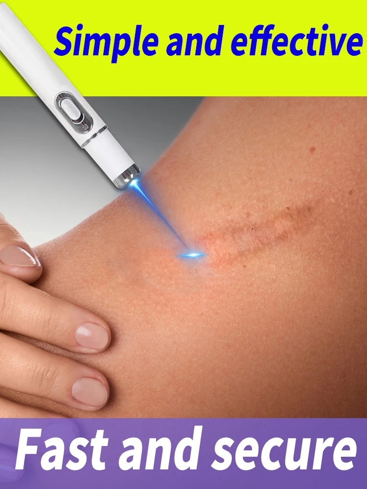 Laser rapid scar repair