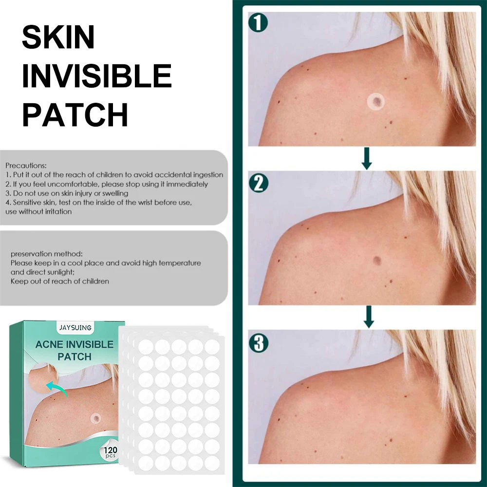 120pcs Invisible Acne Patches Removal Pimple Anti-Acne Hydrocolloid Patches Spots Marks Concealer Repair Sticker Waterproof