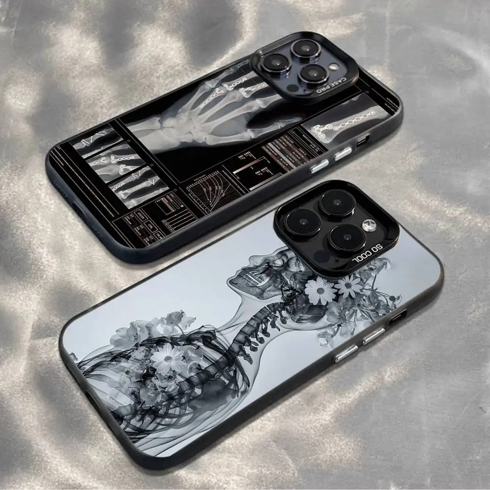 

Radiological human organs Skeleton Phone Case For iPhone 16,15,14,13,12,11,Mini,Pro,MAX,plus,Black Matte Shockproof Cover
