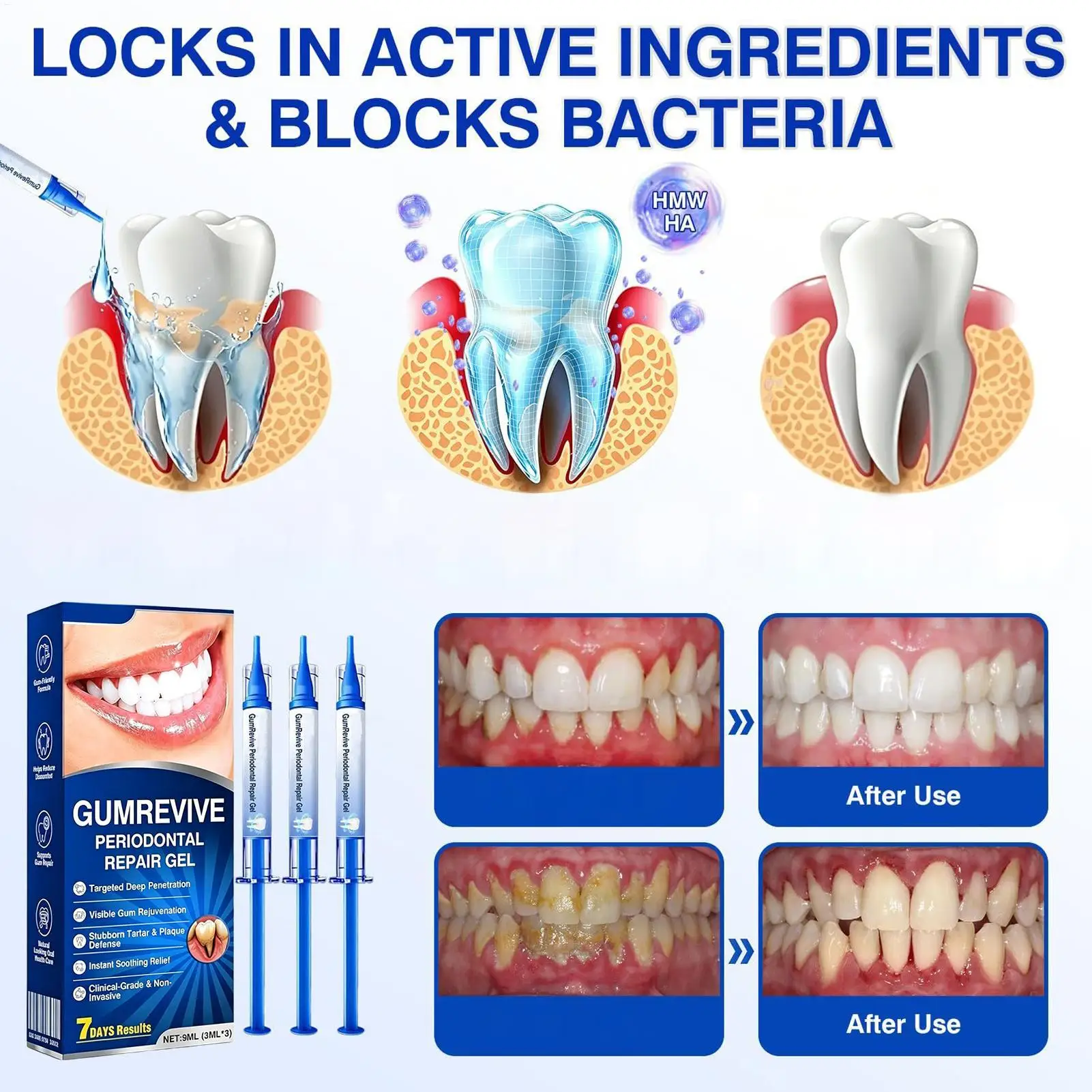 Gum Repair Care Gel Relieve Sore Gum Improve Gingival Damaged Inflammation Cleaning Teeth Stains Tartar Whitener Gum Protect Gel