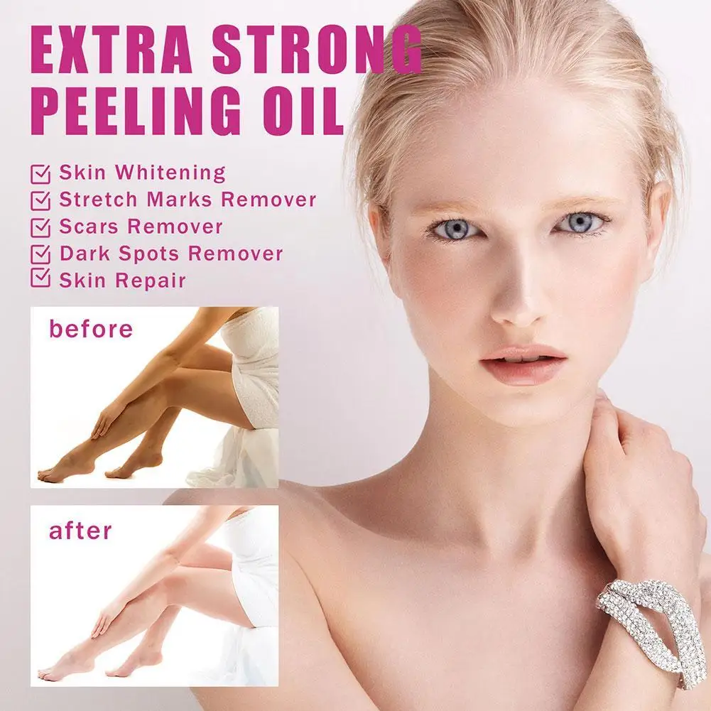 30ML Extra Strong Yellow Peeling Oil Whitening Lighten Care Skin Even Elbows Whiten Skin Hands Knees Tone E7X0