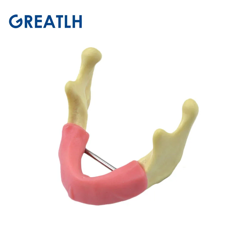 Model praktyki implantów dentystycznych z implantem dziąseł ćwicz żywicę i kość kaczelną