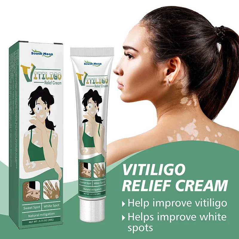 Pomada de extracto de hierbas de Vitiligo, crema de tratamiento para eliminar manchas blancas de la piel, elimina el Vitiligo