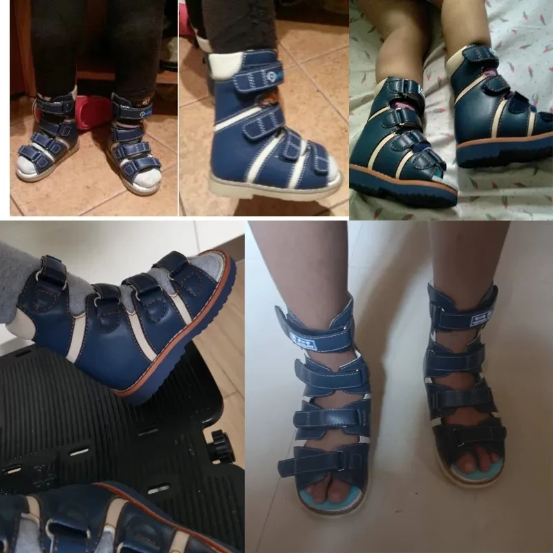 Sepatu sandal ortopedi anak laki-laki, alas kaki Size22-37 kasual High Top, Kelab kulit, alas kaki ortotik medis