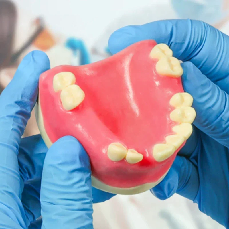 

Teeth Loss Model Dental Implant Student Teaching Training Aid Practice Model Upper Jaw Lift Implants Restoration Model Lab