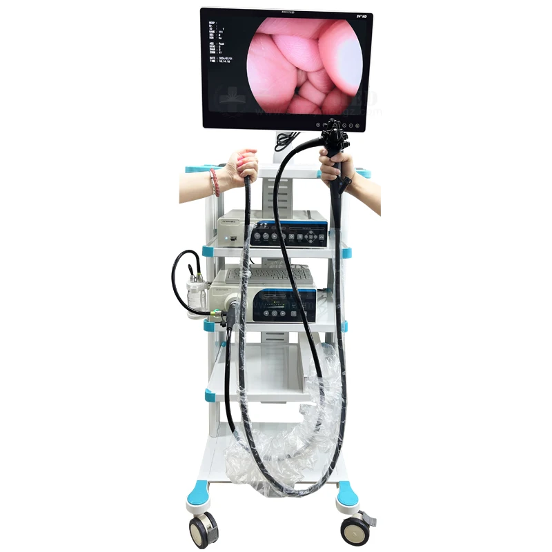 

High-definition hospital gastroscopy, colonoscopy, laparoscopic endoscopic system with forceps