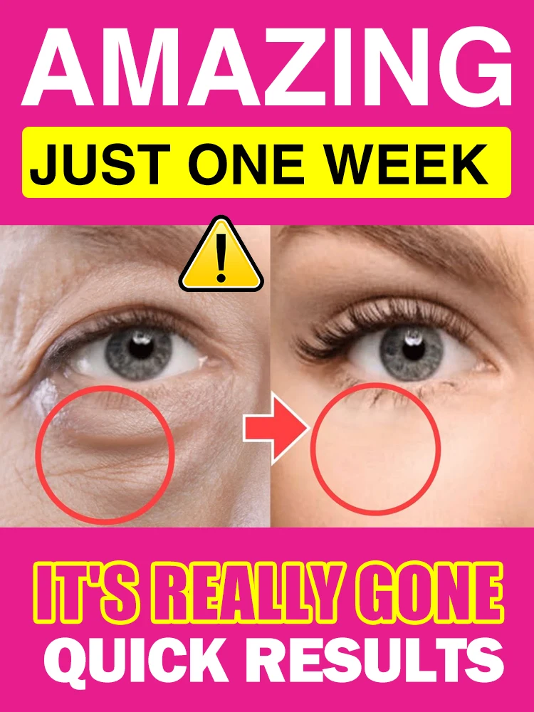 

99% of people will choose this product Solve wrinkles problems and make you 20 years younger