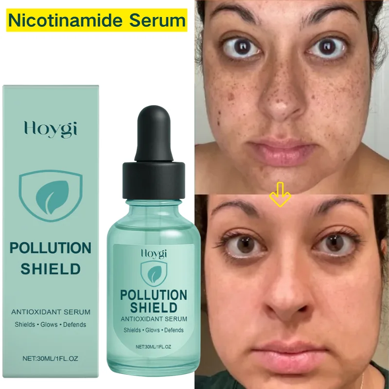 

Niacinamide Whitening Freckle Serum Melasma Dark Spots Pigmentation Removal Fade Stain Melanin Fast Repair Brighten Skin Care