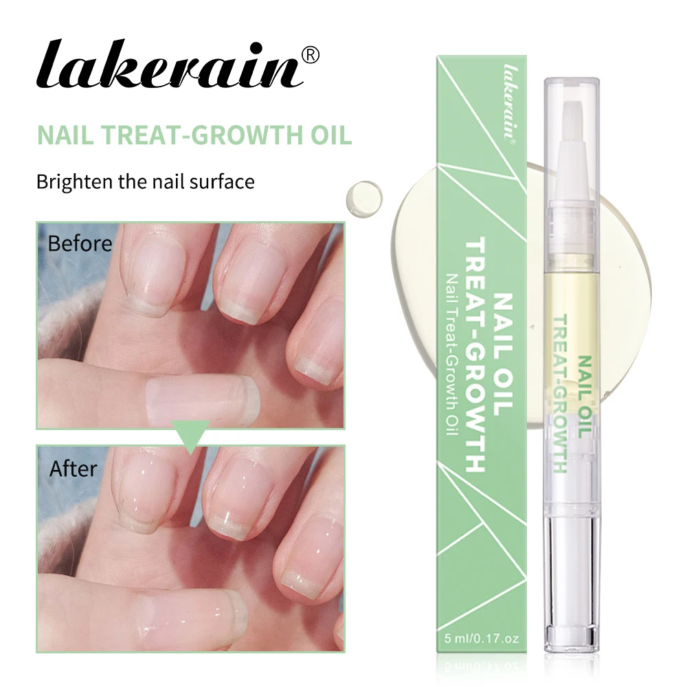 5ml Nail Treat Growth Oil Strengthener Healthy Strong Nail Growth Oil Help Splits Thin Nails Repair Manicure Nail Cuticle Oil