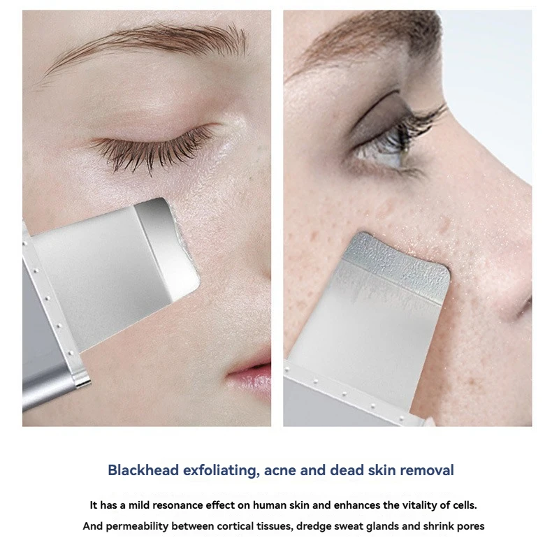 Dispositivo per la pulizia dei pori Raschietto per la pelle Dispositivo di introduzione per la cura del viso Dispositivo per la rimozione di punti neri e cheratina Raschietto per punti neri Massa vibrante