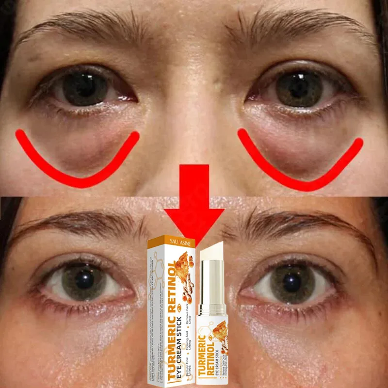 Retinol Anti-Wrinkle Eye Cream Remove Eye Bags Dark Circles Lifting Firming Fade Fine Lines Anti-Puffiness Repair Eye Care Stick