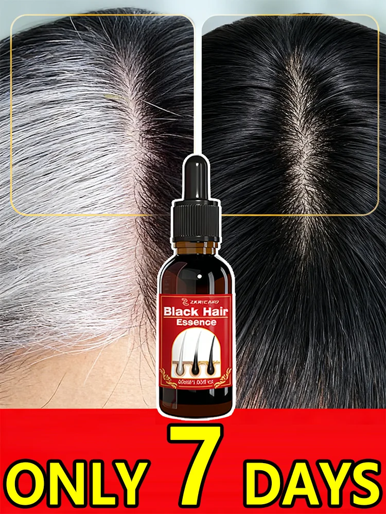 

1-тижневая натуральная черная краска для волос — эффективная сыворотка для мужчин и женщин, мгновенно закрывает седые волосы