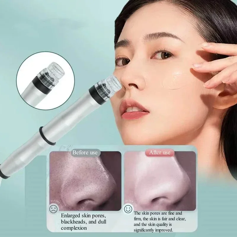 New Portable Facial Blackhead Remover Skin Deep Cleaning for Beauty Salon Vacuum Suction Pore Clean Tool Facial Beauty Machine