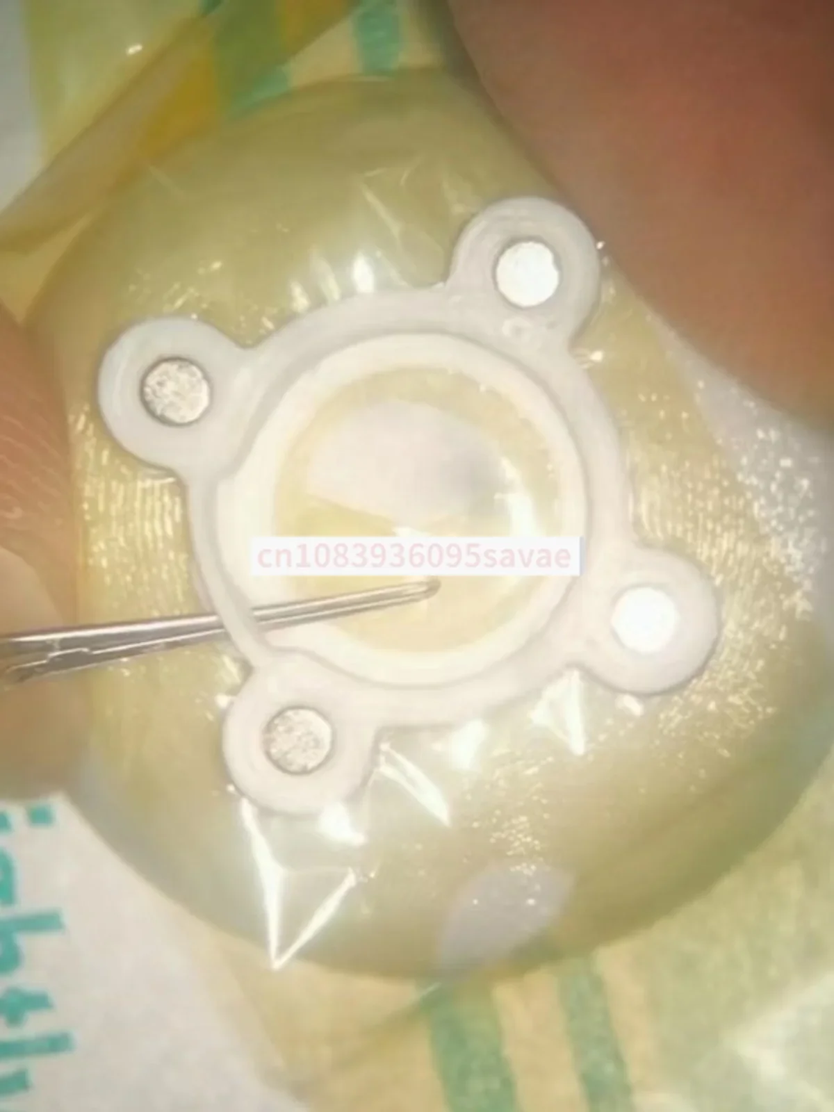 Ophthalmic Cataract Ultrasonic Emulsification Tearing Forceps Ring Tearing Capsule Practice Model