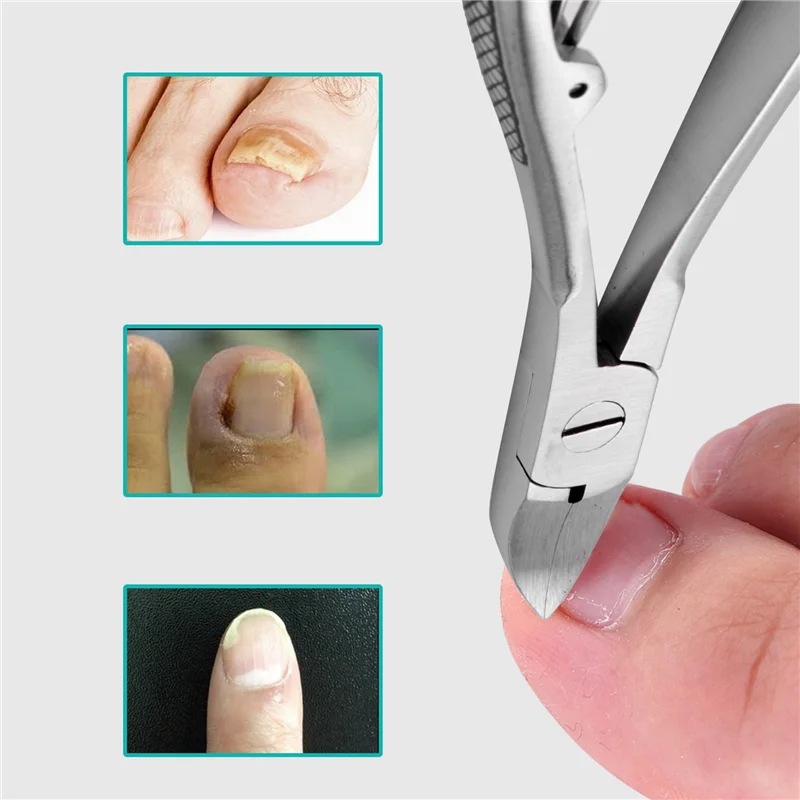 

6X Professional Feet Toe Nail Clippers Trimmer Cutters Paronychia Nippers Chiropody Podiatry Stainless Foot Care Tools