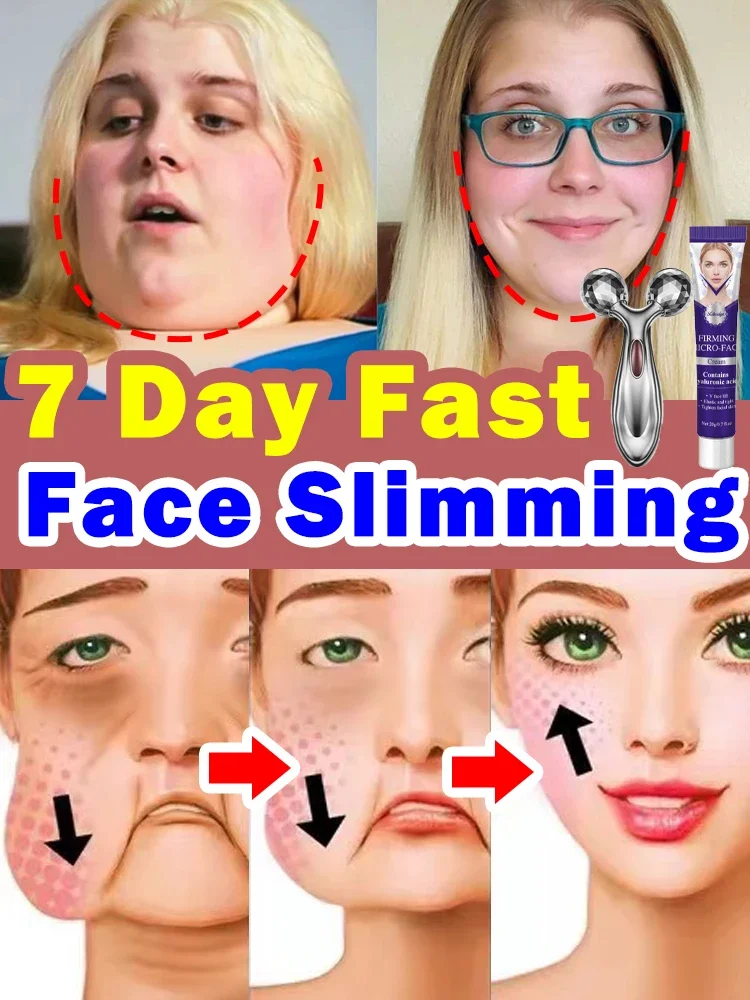 Double chin removal